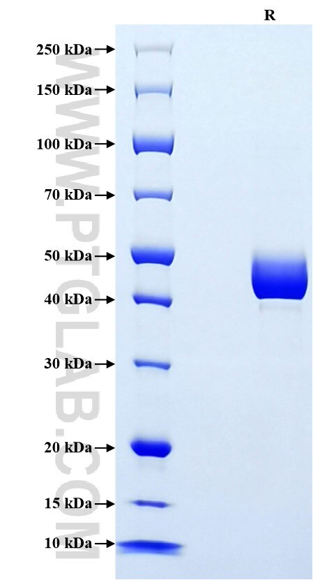 Purity of Recombinant Mouse Leptin was determined by SDS-PAGE. The protein was resolved in an SDS-PAGE in reducing (R) conditions and stained using Coomassie blue.