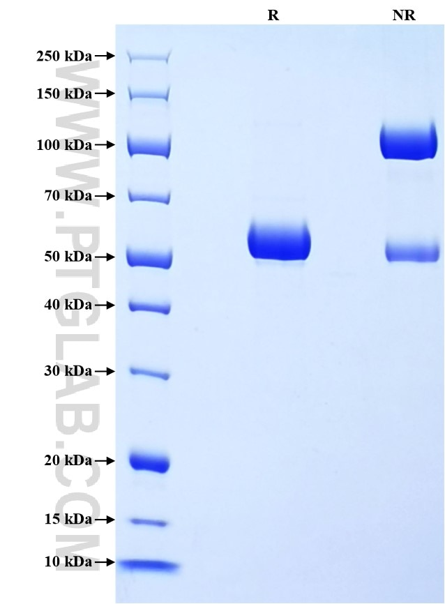 Purity of Recombinant Mouse IL-27A was determined by SDS-PAGE. The protein was resolved in an SDS-PAGE in reducing (R) and non-reducing (NR) conditions and stained using Coomassie blue. Purity of Recombinant Mouse IL-27A was determined by SDS-PAGE. The protein was resolved in an SDS-PAGE in reducing (R) and non-reducing (NR) conditions and stained using Coomassie blue.