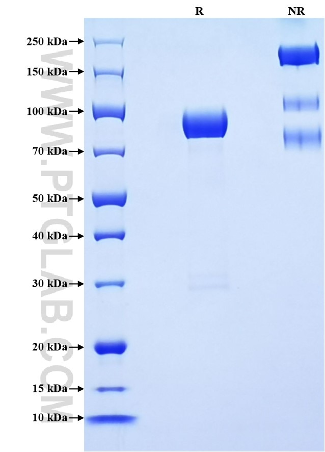 Purity of Recombinant Human BACE1 was determined by SDS-PAGE. The protein was resolved in an SDS-PAGE in reducing (R) and non-reducing (NR) conditions and stained using Coomassie blue.