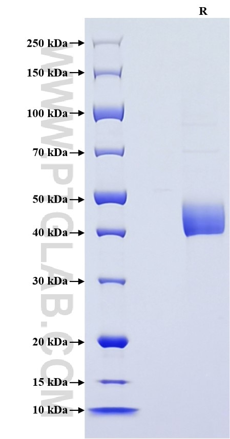 Purity of Recombinant Human MIF was determined by SDS-PAGE. The protein was resolved in an SDS-PAGE in reducing (R) conditions and stained using Coomassie blue. Purity of Recombinant Human MIF was determined by SDS-PAGE. The protein was resolved in an SDS-PAGE in reducing (R) conditions and stained using Coomassie blue.
