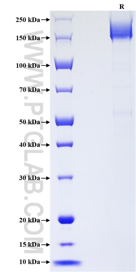 Purity of Recombinant Human A2ML1 was determined by SDS-PAGE. The protein was resolved in an SDS-PAGE in reducing (R) conditions and stained using Coomassie blue. Purity of Recombinant Human A2ML1 was determined by SDS-PAGE. The protein was resolved in an SDS-PAGE in reducing (R) conditions and stained using Coomassie blue.