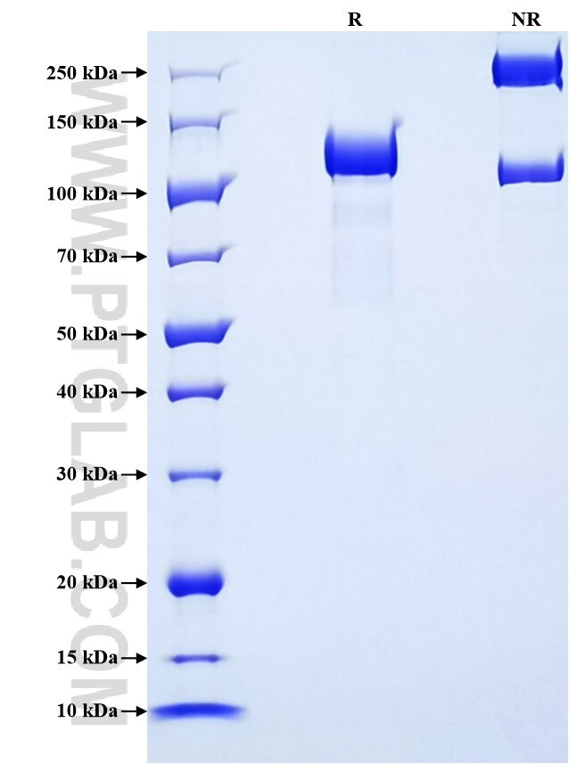 Purity of Recombinant Human Complement C6 was determined by SDS-PAGE. The protein was resolved in an SDS-PAGE in reducing (R) and non-reducing (NR) conditions and stained using Coomassie blue.