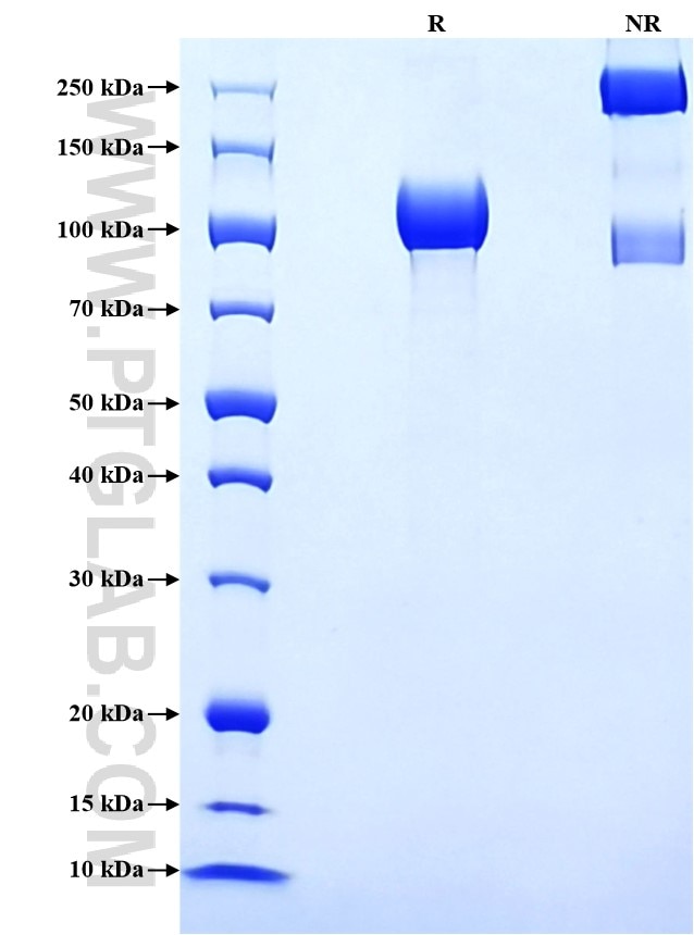 Purity of Recombinant Rhesus Monkey VCAM-1 was determined by SDS-PAGE. The protein was resolved in an SDS-PAGE in reducing (R) and non-reducing (NR) conditions and stained using Coomassie blue. Purity of Recombinant Rhesus Monkey VCAM-1 was determined by SDS-PAGE. The protein was resolved in an SDS-PAGE in reducing (R) and non-reducing (NR) conditions and stained using Coomassie blue.