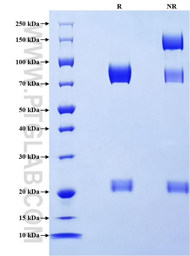 Purity of Recombinant Human GGT1 was determined by SDS-PAGE. The protein was resolved in an SDS-PAGE in reducing (R) and non-reducing (NR) conditions and stained using Coomassie blue.