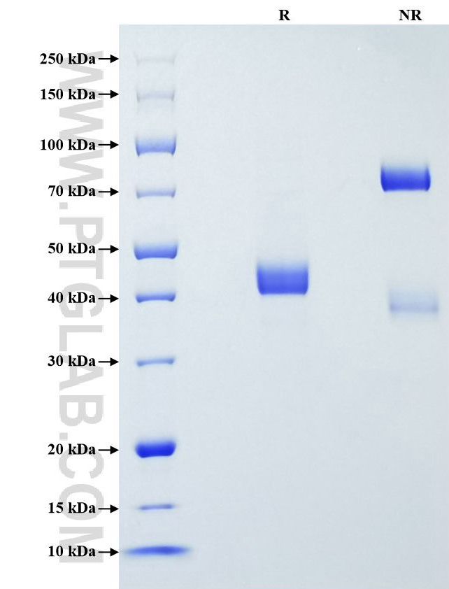 Purity of Recombinant Human Lysozyme was determined by SDS-PAGE. The protein was resolved in an SDS-PAGE in reducing (R) and non-reducing (NR) conditions and stained using Coomassie blue.