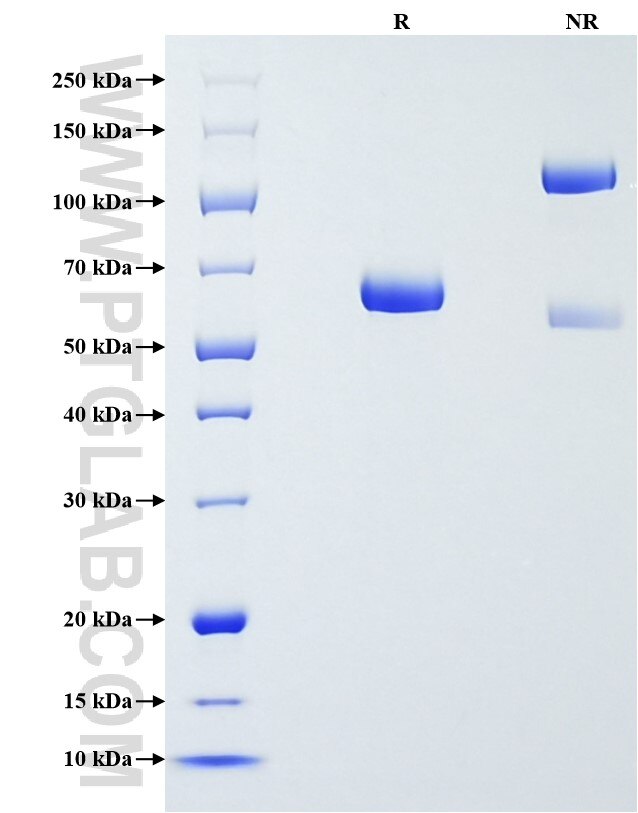 Purity of Recombinant Human Fibrinogen Alpha Chain was determined by SDS-PAGE. The protein was resolved in an SDS-PAGE in reducing (R) and non-reducing (NR) conditions and stained using Coomassie blue.