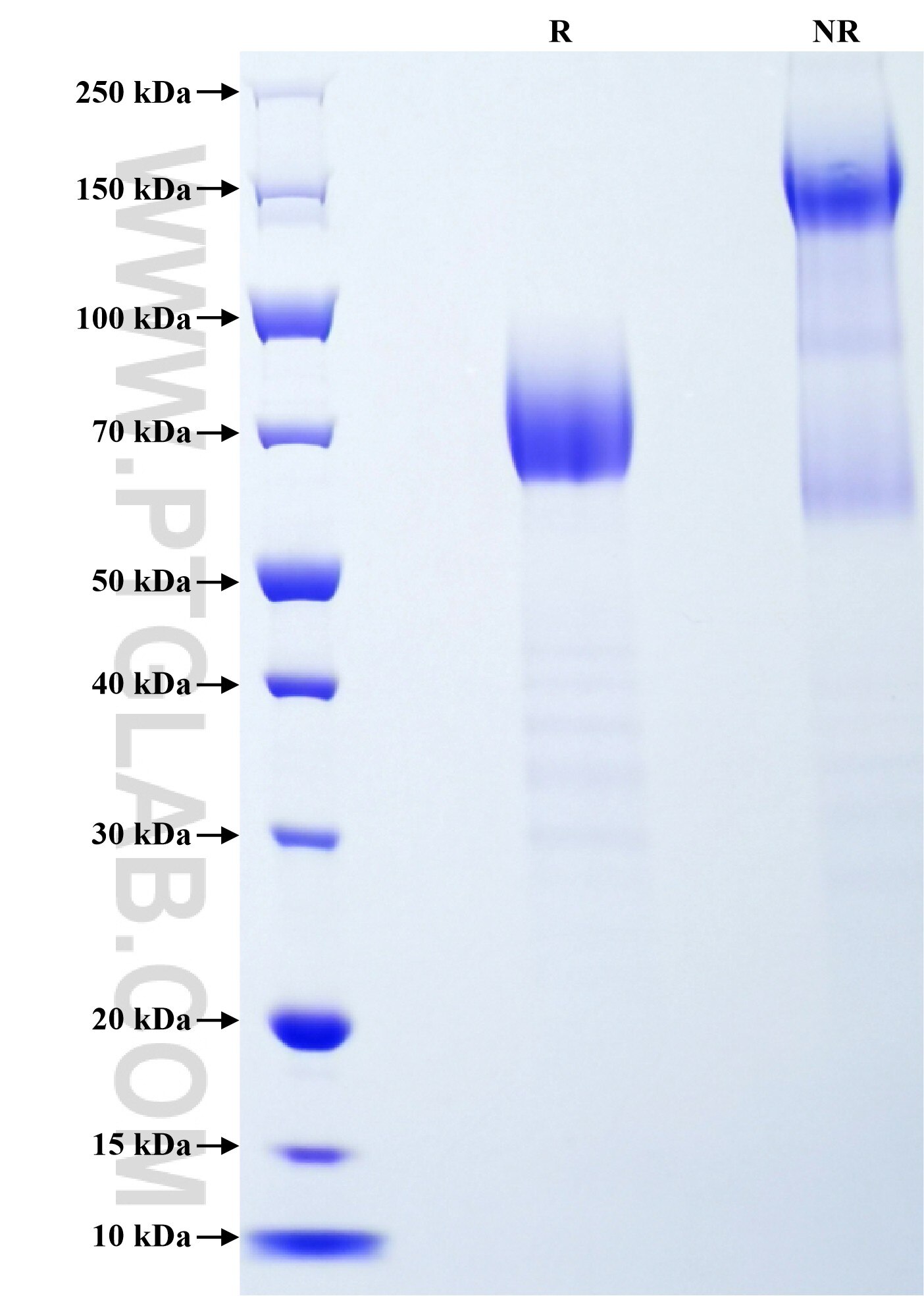 Purity of Recombinant Human DcR1 was determined by SDS-PAGE. The protein was resolved in an SDS-PAGE in reducing (R) and non-reducing (NR) conditions and stained using Coomassie blue. Purity of Recombinant Human DcR1 was determined by SDS-PAGE. The protein was resolved in an SDS-PAGE in reducing (R) and non-reducing (NR) conditions and stained using Coomassie blue.