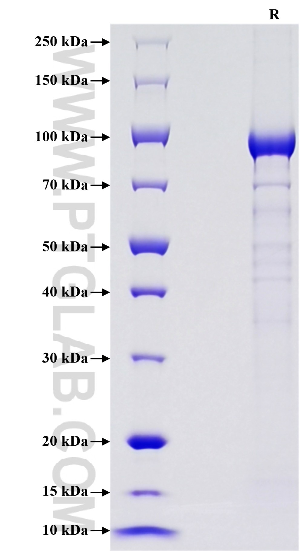 Purity of Recombinant Human Vitronectin was determined by SDS-PAGE. The protein was resolved in an SDS-PAGE in reducing (R) conditions and stained using Coomassie blue.