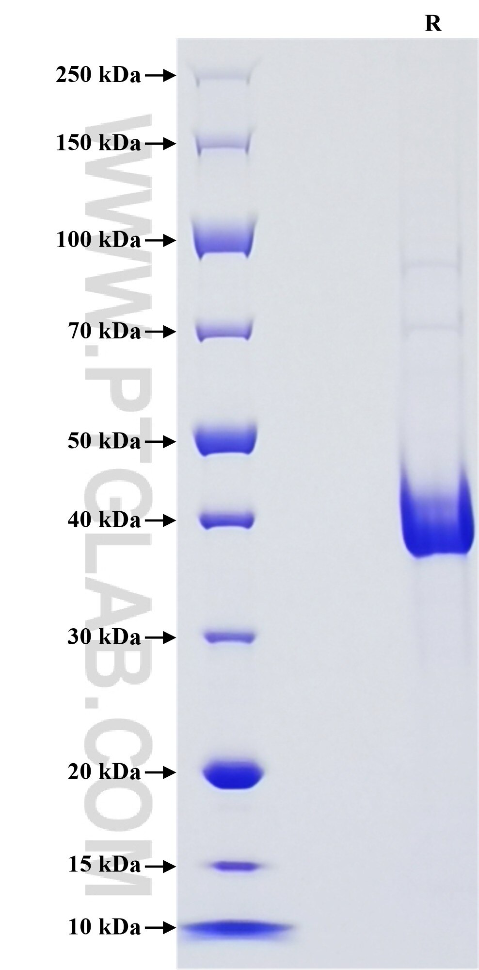 Purity of Recombinant Human SAA was determined by SDS-PAGE. The protein was resolved in an SDS-PAGE in reducing (R) conditions and stained using Coomassie blue.