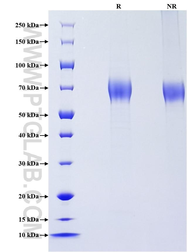 Purity of Recombinant Human LILRA1 was determined by SDS-PAGE. The protein was resolved in an SDS-PAGE in reducing (R) and non-reducing (NR) conditions and stained using Coomassie blue. Purity of Recombinant Human LILRA1 was determined by SDS-PAGE. The protein was resolved in an SDS-PAGE in reducing (R) and non-reducing (NR) conditions and stained using Coomassie blue.