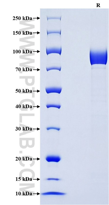 Purity of Recombinant Mouse MSR1 was determined by SDS-PAGE. The protein was resolved in an SDS-PAGE in reducing (R) condition and stained using Coomassie blue.