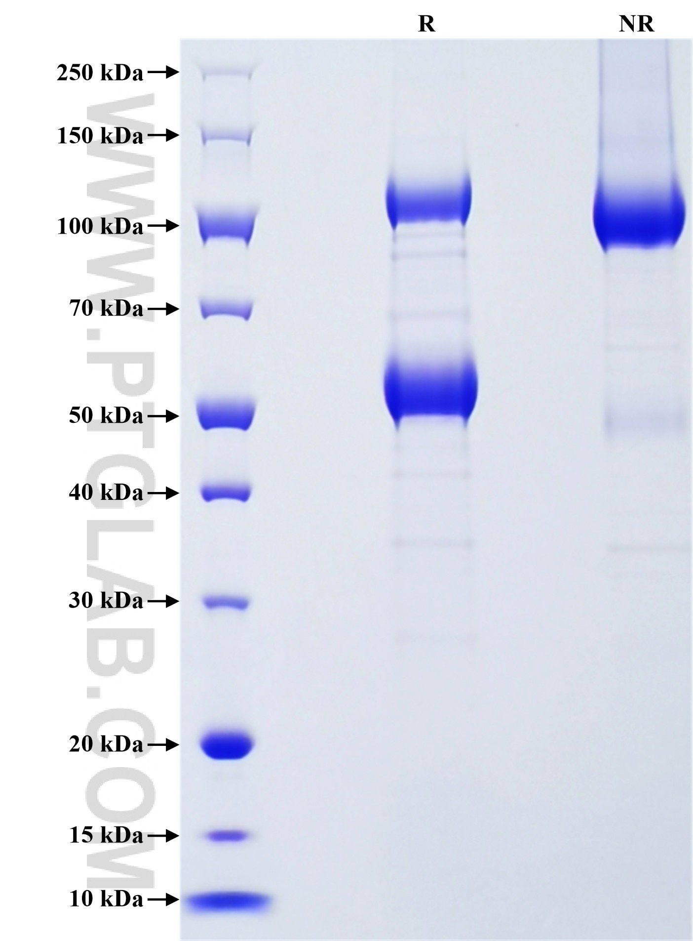 Purity of Recombinant Human CLEC-2 was determined by SDS-PAGE. The protein was resolved in an SDS-PAGE in reducing (R) and non-reducing (NR) conditions and stained using Coomassie blue.