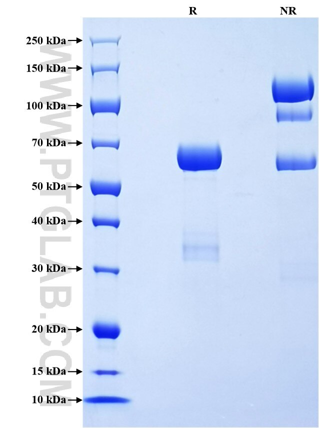 Purity of Recombinant Human PGC was determined by SDS-PAGE. The protein was resolved in an SDS-PAGE in reducing (R) and non-reducing (NR) conditions and stained using Coomassie blue. Purity of Recombinant Human PGC was determined by SDS-PAGE. The protein was resolved in an SDS-PAGE in reducing (R) and non-reducing (NR) conditions and stained using Coomassie blue.