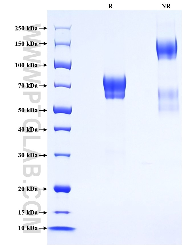 Purity of Recombinant Human NGFR was determined by SDS-PAGE. The protein was resolved in an SDS-PAGE in reducing (R) and non-reducing (NR) conditions and stained using Coomassie blue. Purity of Recombinant Human NGFR was determined by SDS-PAGE. The protein was resolved in an SDS-PAGE in reducing (R) and non-reducing (NR) conditions and stained using Coomassie blue.