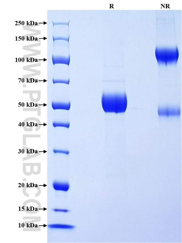 Purity of Recombinant Human CD8B was determined by SDS-PAGE. The protein was resolved in an SDS-PAGE in reducing (R) and non-reducing (NR) conditions and stained using Coomassie blue.
