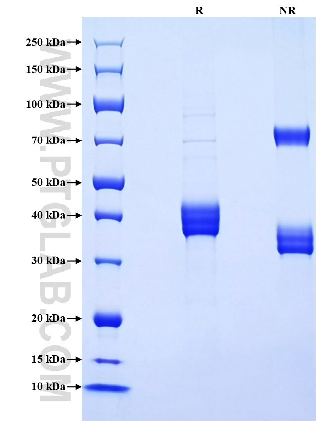 Purity of Recombinant Pig CXCL8 was determined by SDS-PAGE. The protein was resolved in an SDS-PAGE in reducing (R) and non-reducing (NR) conditions and stained using Coomassie blue.