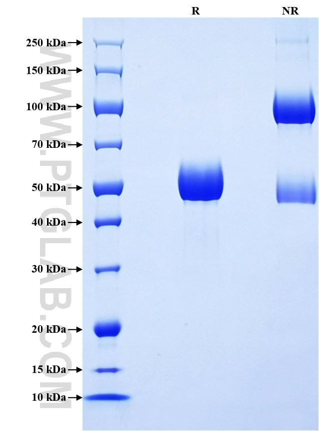 Purity of Recombinant Pig IL-6 was determined by SDS-PAGE. The protein was resolved in an SDS-PAGE in reducing (R) and non-reducing (NR) conditions and stained using Coomassie blue. Purity of Recombinant Pig IL-6 was determined by SDS-PAGE. The protein was resolved in an SDS-PAGE in reducing (R) and non-reducing (NR) conditions and stained using Coomassie blue.