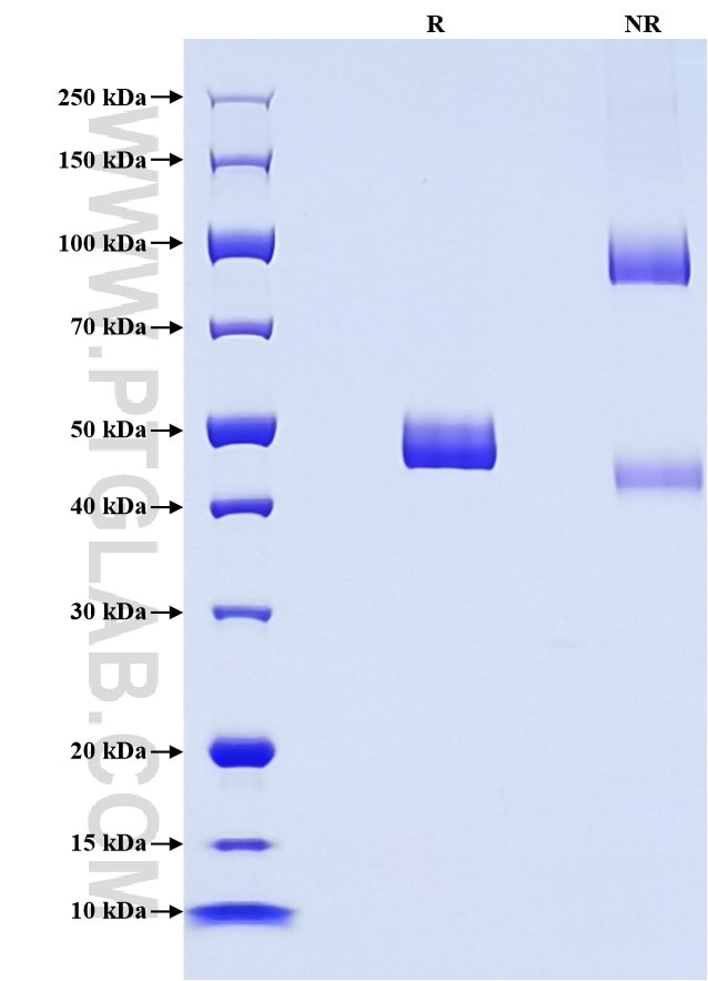Purity of Recombinant Pig IL-1 beta was determined by SDS-PAGE. The protein was resolved in an SDS-PAGE in reducing (R) and non-reducing (NR) conditions and stained using Coomassie blue. Purity of Recombinant Pig IL-1 beta was determined by SDS-PAGE. The protein was resolved in an SDS-PAGE in reducing (R) and non-reducing (NR) conditions and stained using Coomassie blue.