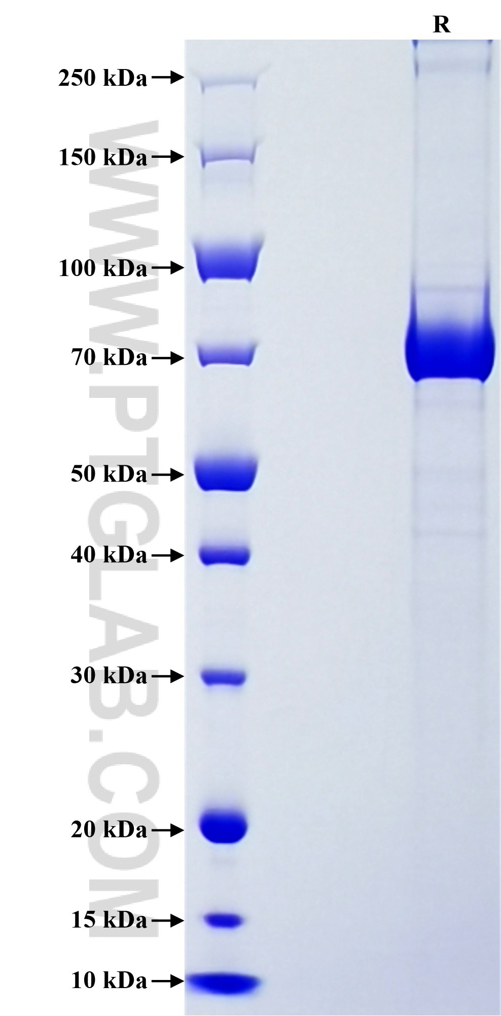 Purity of Recombinant Human GAS6 was determined by SDS-PAGE. The protein was resolved in an SDS-PAGE in reducing (R) conditions and stained using Coomassie blue.