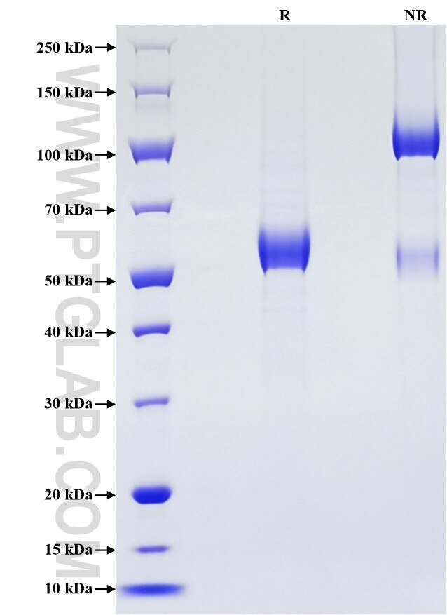 Purity of Recombinant Human ATP1B3 was determined by SDS-PAGE. The protein was resolved in an SDS-PAGE in reducing (R) and non-reducing (NR) conditions and stained using Coomassie blue.