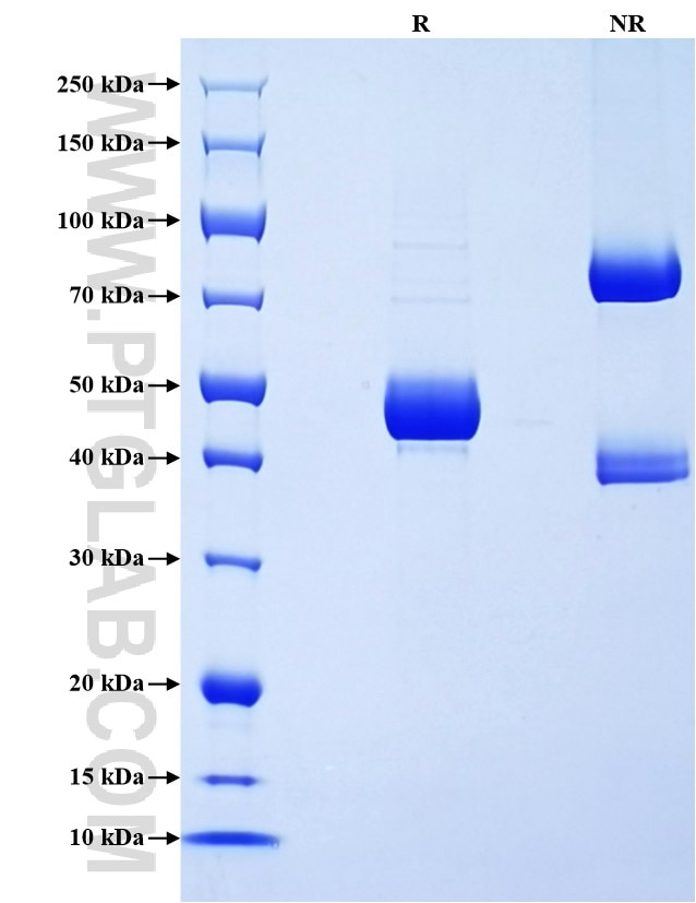 Purity of Recombinant Human IFNA8 was determined by SDS-PAGE. The protein was resolved in an SDS-PAGE in reducing (R) and non-reducing (NR) conditions and stained using Coomassie blue. Purity of Recombinant Human IFNA8 was determined by SDS-PAGE. The protein was resolved in an SDS-PAGE in reducing (R) and non-reducing (NR) conditions and stained using Coomassie blue.