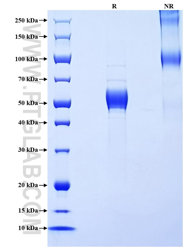 Purity of Recombinant Human IL-1F6 was determined by SDS-PAGE. The protein was resolved in an SDS-PAGE in reducing (R) and non-reducing (NR) conditions and stained using Coomassie blue.