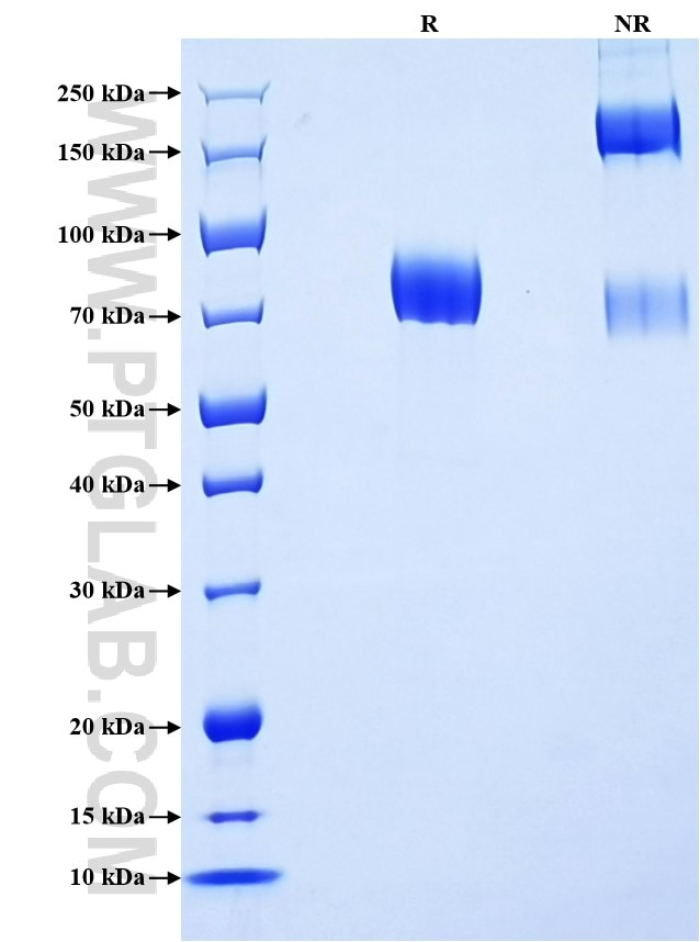 Purity of Recombinant Human IL-17RD was determined by SDS-PAGE. The protein was resolved in an SDS-PAGE in reducing (R) and non-reducing (NR) conditions and stained using Coomassie blue. Purity of Recombinant Human IL-17RD was determined by SDS-PAGE. The protein was resolved in an SDS-PAGE in reducing (R) and non-reducing (NR) conditions and stained using Coomassie blue.