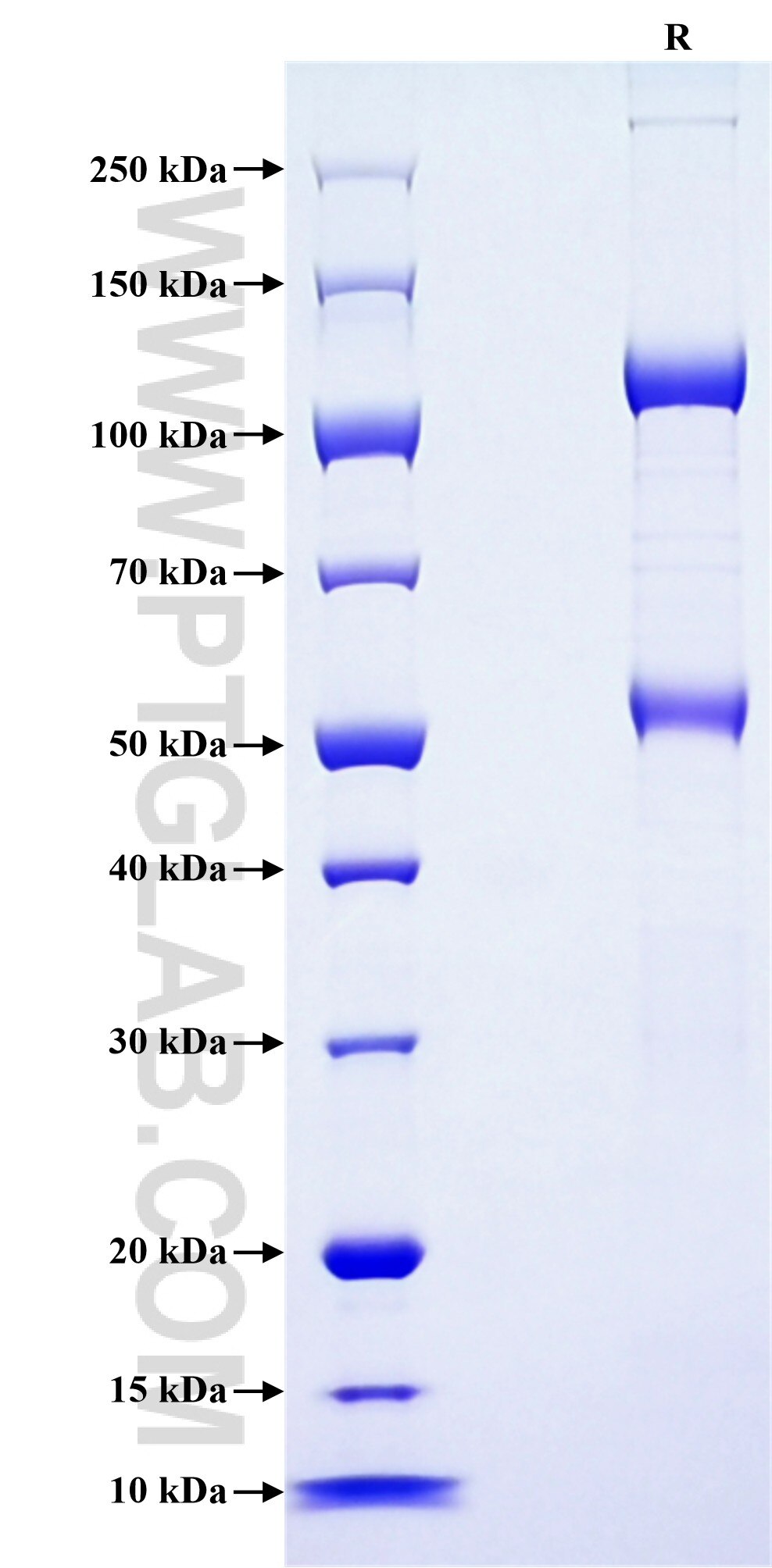 Purity of Recombinant Human SEMA3C was determined by SDS-PAGE. The protein was resolved in an SDS-PAGE in reducing (R) conditions and stained using Coomassie blue.