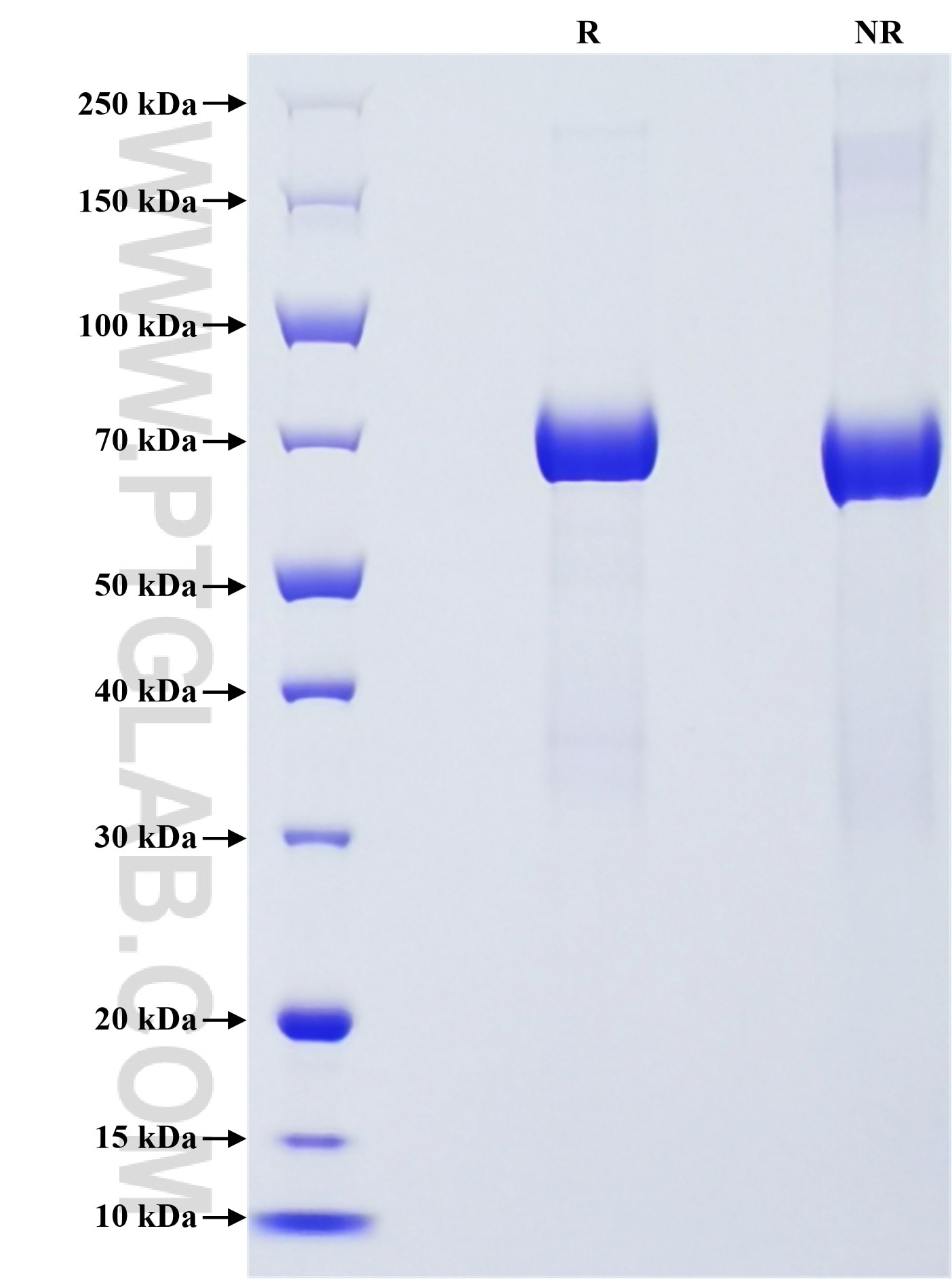 Purity of Recombinant Human Surfactant protein D was determined by SDS-PAGE. The protein was resolved in an SDS-PAGE in reducing (R) and non-reducing (NR) conditions and stained using Coomassie blue.