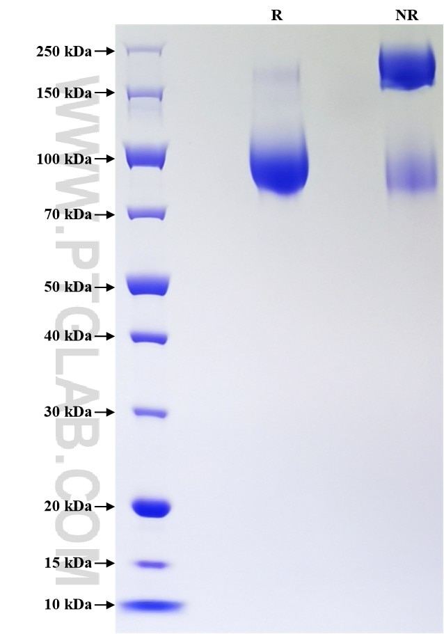 Purity of Recombinant Human LAMP2 was determined by SDS-PAGE. The protein was resolved in an SDS-PAGE in reducing (R) and non-reducing (NR) conditions and stained using Coomassie blue.