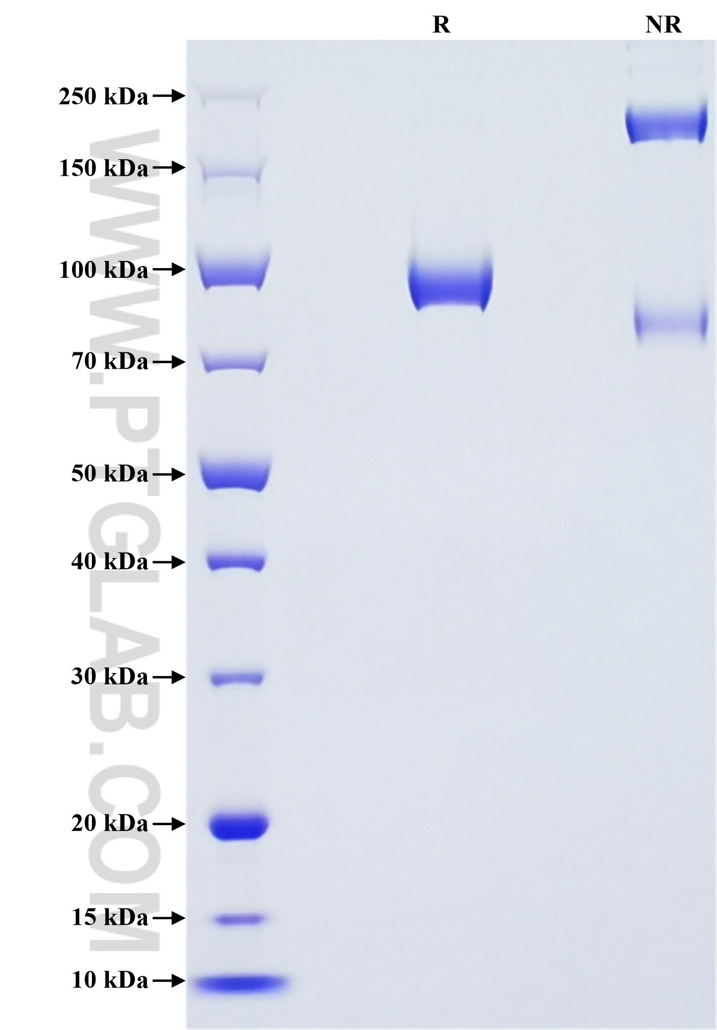 Purity of Recombinant Mouse Siglec1 was determined by SDS-PAGE. The protein was resolved in an SDS-PAGE in reducing (R) and non-reducing (NR) conditions and stained using Coomassie blue. Purity of Recombinant Mouse Siglec1 was determined by SDS-PAGE. The protein was resolved in an SDS-PAGE in reducing (R) and non-reducing (NR) conditions and stained using Coomassie blue.
