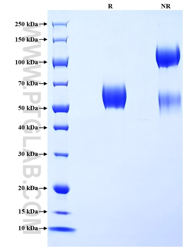 Purity of Recombinant Human CLEC5A was determined by SDS-PAGE. The protein was resolved in an SDS-PAGE in reducing (R) and non-reducing (NR) conditions and stained using Coomassie blue.