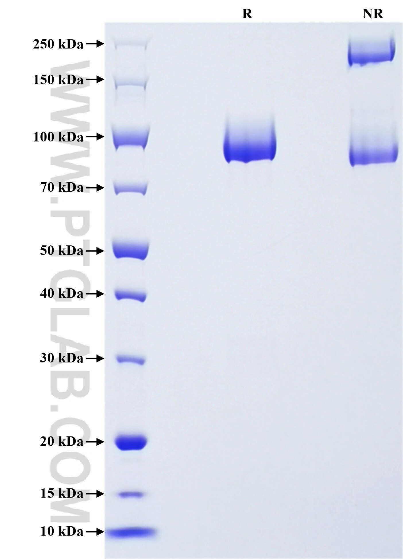 Purity of Recombinant Human ALCAM was determined by SDS-PAGE. The protein was resolved in an SDS-PAGE in reducing (R) and non-reducing (NR) conditions and stained using Coomassie blue. Purity of Recombinant Human ALCAM was determined by SDS-PAGE. The protein was resolved in an SDS-PAGE in reducing (R) and non-reducing (NR) conditions and stained using Coomassie blue.