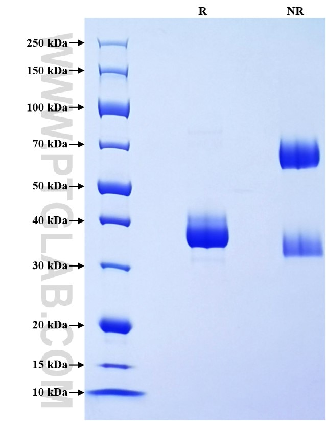 Purity of Recombinant Human CCL3L1 was determined by SDS-PAGE. The protein was resolved in an SDS-PAGE in reducing (R) and non-reducing (NR) conditions and stained using Coomassie blue. Purity of Recombinant Human CCL3L1 was determined by SDS-PAGE. The protein was resolved in an SDS-PAGE in reducing (R) and non-reducing (NR) conditions and stained using Coomassie blue.