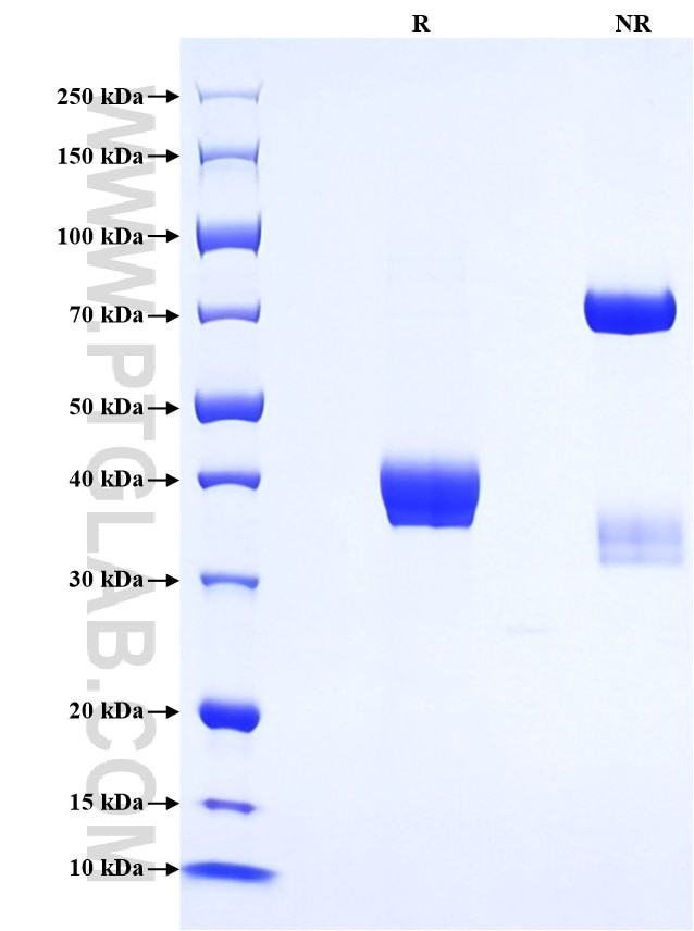 Purity of Recombinant Human CCL8 was determined by SDS-PAGE. The protein was resolved in an SDS-PAGE in reducing (R) and non-reducing (NR) conditions and stained using Coomassie blue. Purity of Recombinant Human CCL8 was determined by SDS-PAGE. The protein was resolved in an SDS-PAGE in reducing (R) and non-reducing (NR) conditions and stained using Coomassie blue.