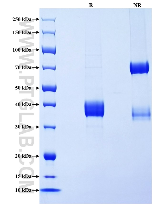 Purity of Recombinant Human CCL18 was determined by SDS-PAGE. The protein was resolved in an SDS-PAGE in reducing (R) and non-reducing (NR) conditions and stained using Coomassie blue.