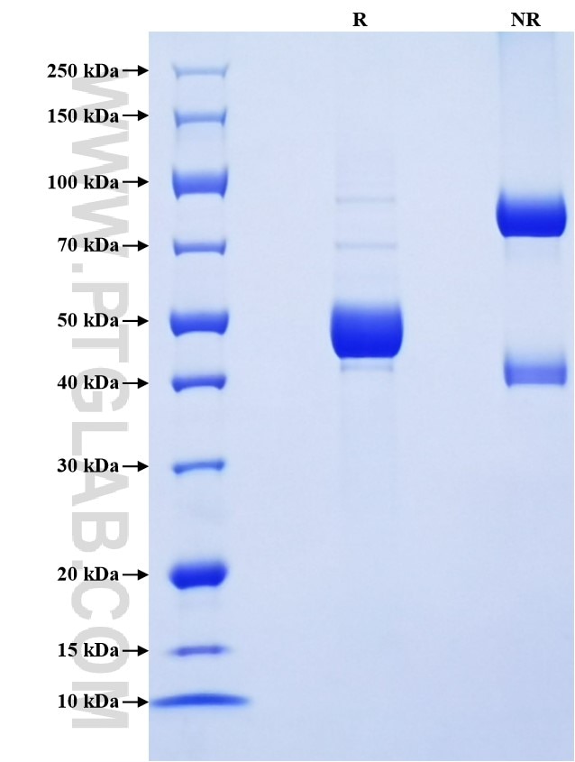 Purity of Recombinant Human IFNA21 was determined by SDS-PAGE. The protein was resolved in an SDS-PAGE in reducing (R) and non-reducing (NR) conditions and stained using Coomassie blue. Purity of Recombinant Human IFNA21 was determined by SDS-PAGE. The protein was resolved in an SDS-PAGE in reducing (R) and non-reducing (NR) conditions and stained using Coomassie blue.