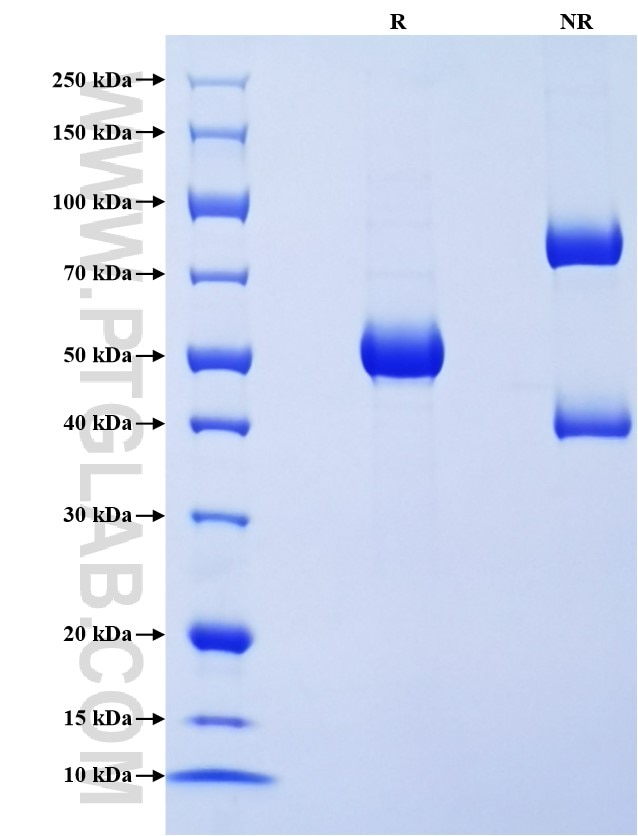 Purity of Recombinant Human IFNA16 was determined by SDS-PAGE. The protein was resolved in an SDS-PAGE in reducing (R) and non-reducing (NR) conditions and stained using Coomassie blue. Purity of Recombinant Human IFNA16 was determined by SDS-PAGE. The protein was resolved in an SDS-PAGE in reducing (R) and non-reducing (NR) conditions and stained using Coomassie blue.