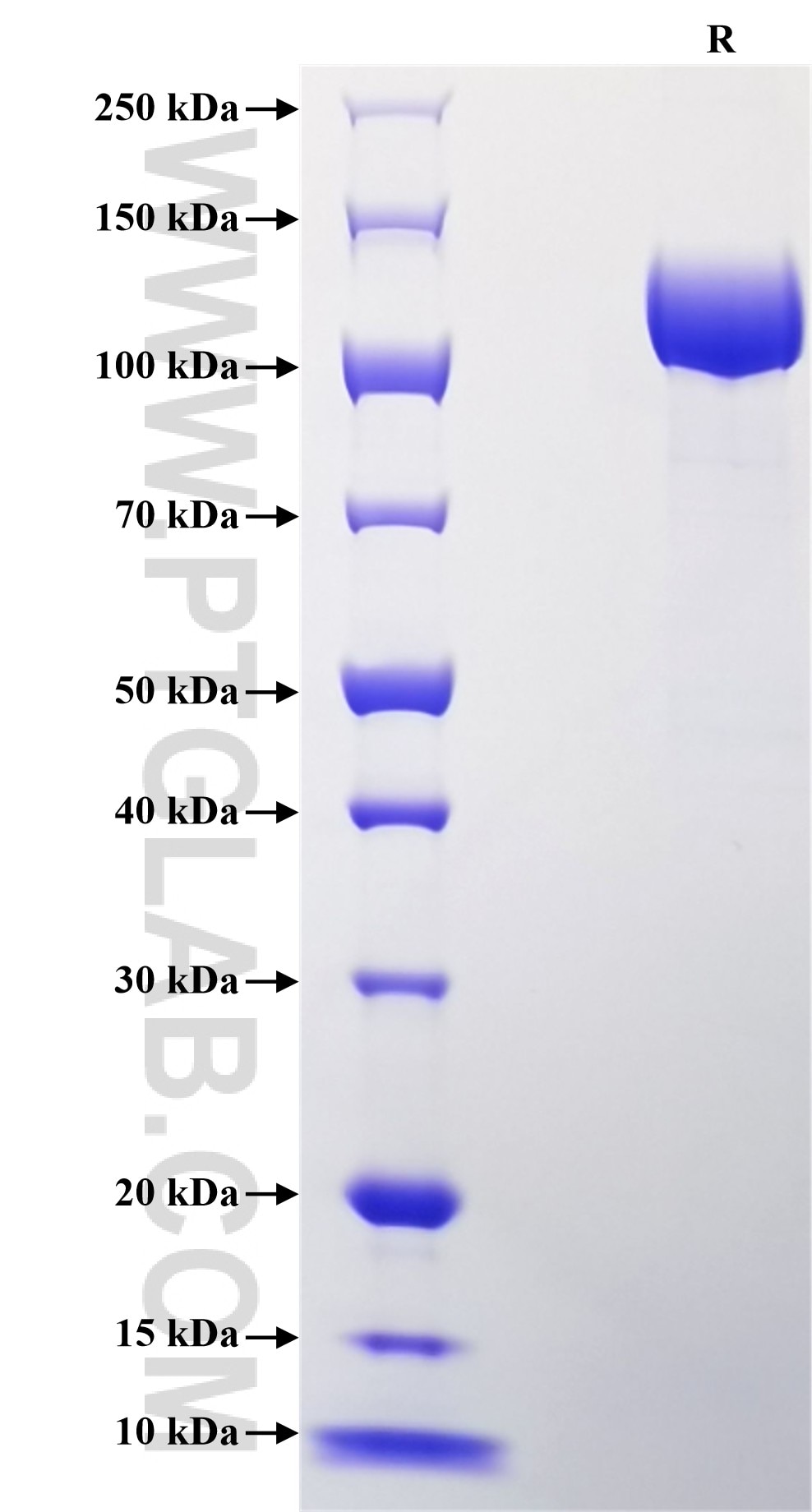 Purity of Recombinant Human AGRN was determined by SDS-PAGE. The protein was resolved in an SDS-PAGE in reducing (R) conditions and stained using Coomassie blue.