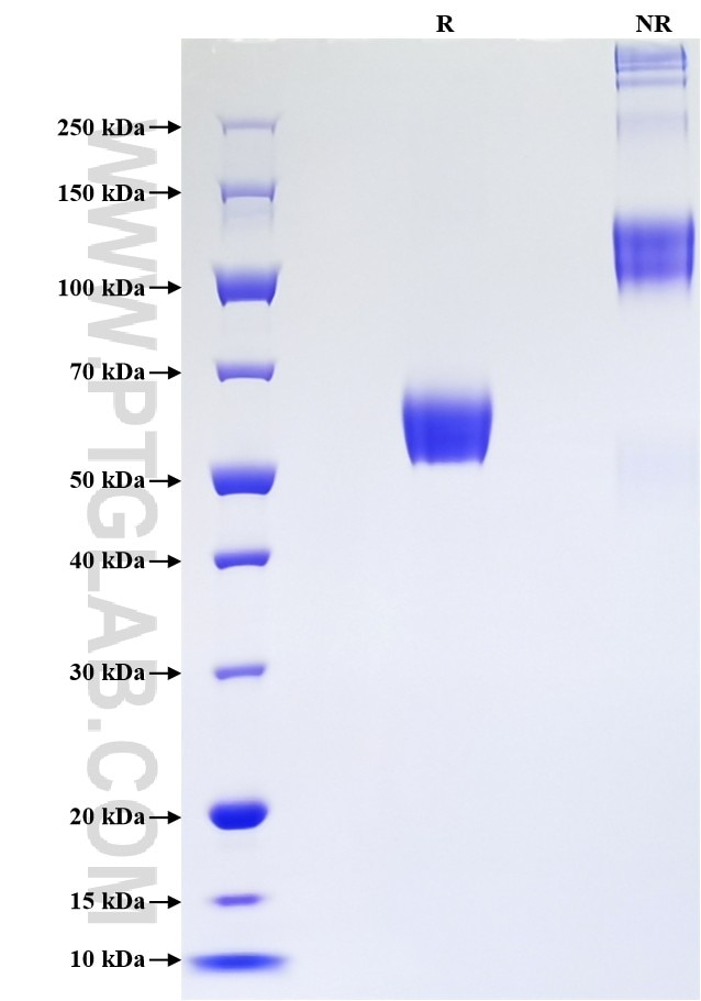Purity of Recombinant Human LTBR was determined by SDS-PAGE. The protein was resolved in an SDS-PAGE in reducing (R) and non-reducing (NR) conditions and stained using Coomassie blue.