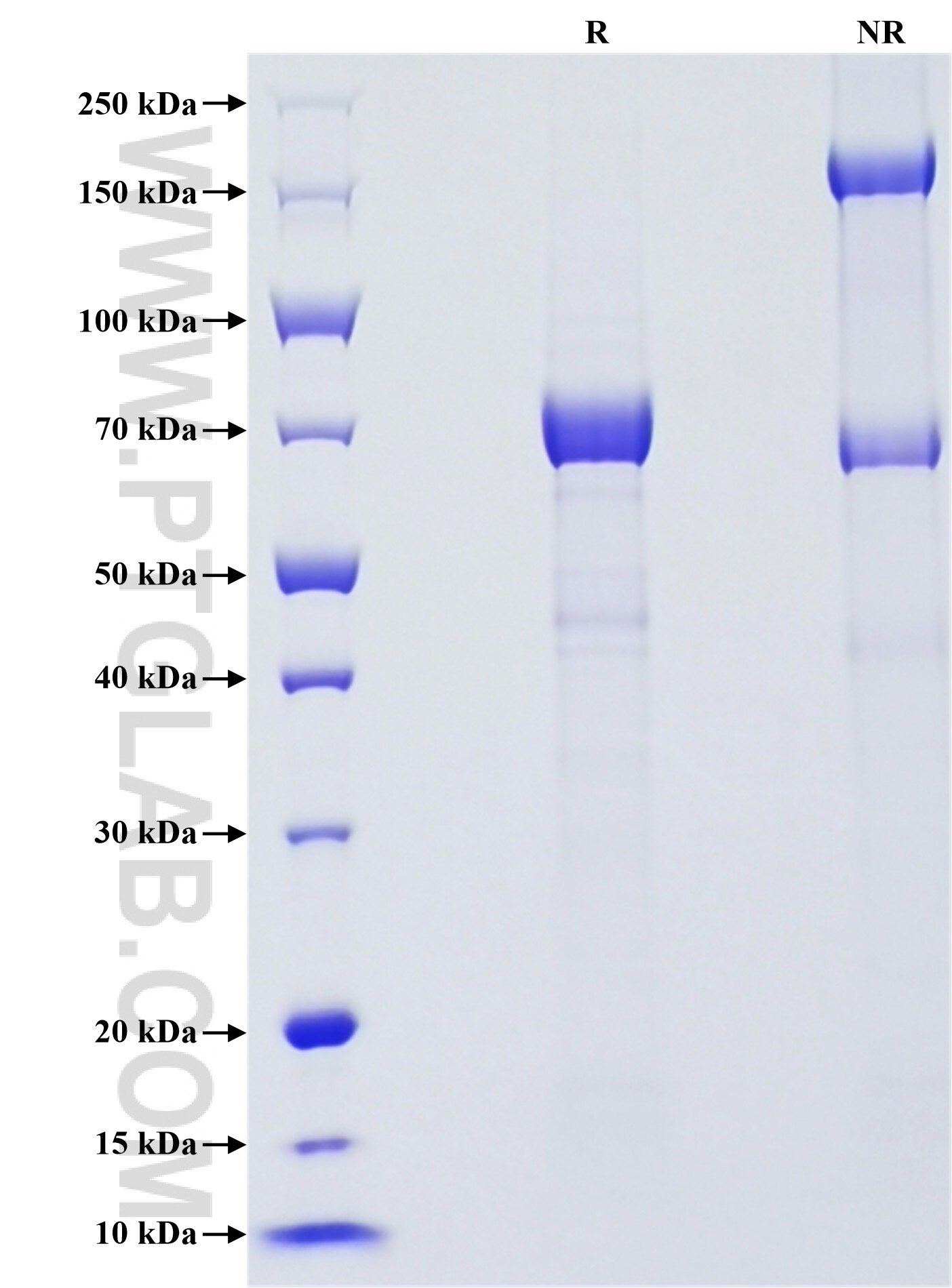 Purity of Recombinant Human P-cadherin was determined by SDS-PAGE. The protein was resolved in an SDS-PAGE in reducing (R) and non-reducing (NR) conditions and stained using Coomassie blue. Purity of Recombinant Human P-cadherin was determined by SDS-PAGE. The protein was resolved in an SDS-PAGE in reducing (R) and non-reducing (NR) conditions and stained using Coomassie blue.