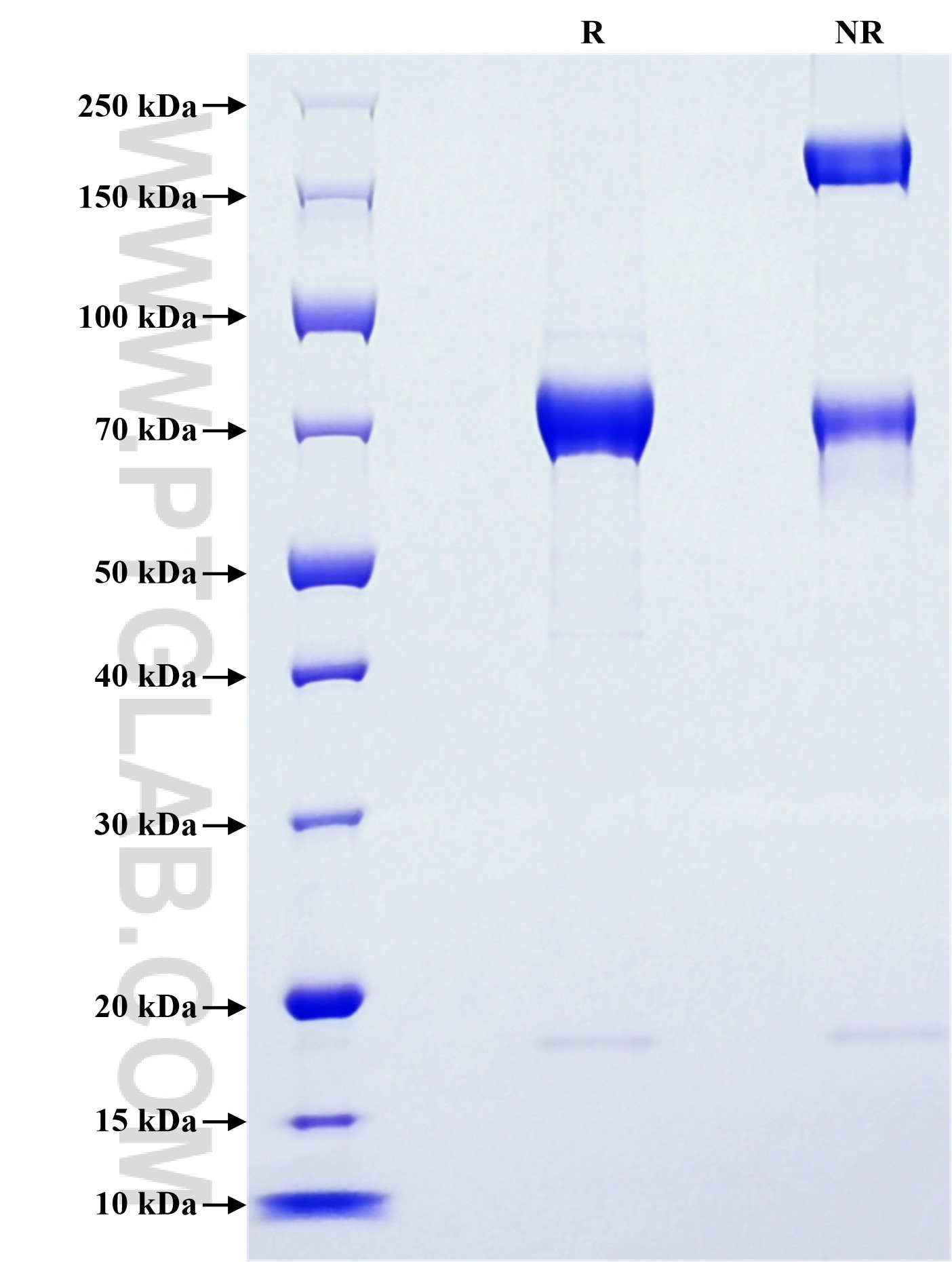 Purity of Recombinant Mouse ST6GAL1 was determined by SDS-PAGE. The protein was resolved in an SDS-PAGE in reducing (R) and non-reducing (NR) conditions and stained using Coomassie blue. Purity of Recombinant Mouse ST6GAL1 was determined by SDS-PAGE. The protein was resolved in an SDS-PAGE in reducing (R) and non-reducing (NR) conditions and stained using Coomassie blue.