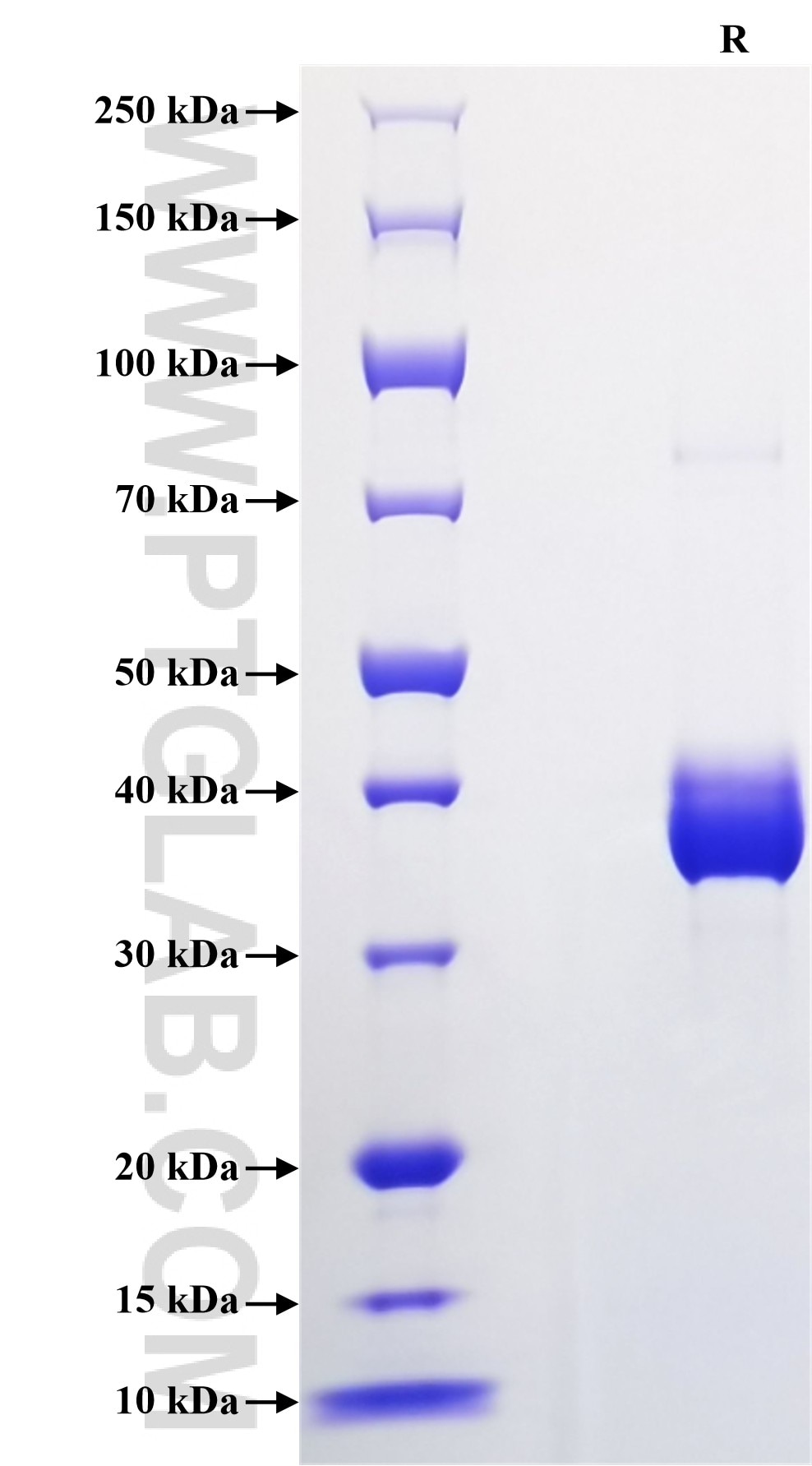 Purity of Recombinant Human Resistin was determined by SDS-PAGE. The protein was resolved in an SDS-PAGE in reducing (R) conditions and stained using Coomassie blue.