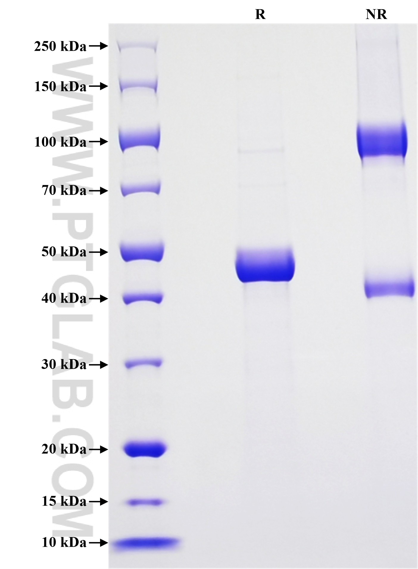 Purity of Recombinant Human CIB1 was determined by SDS-PAGE. The protein was resolved in an SDS-PAGE in reducing (R) and non-reducing (NR) conditions and stained using Coomassie blue. Purity of Recombinant Human CIB1 was determined by SDS-PAGE. The protein was resolved in an SDS-PAGE in reducing (R) and non-reducing (NR) conditions and stained using Coomassie blue.