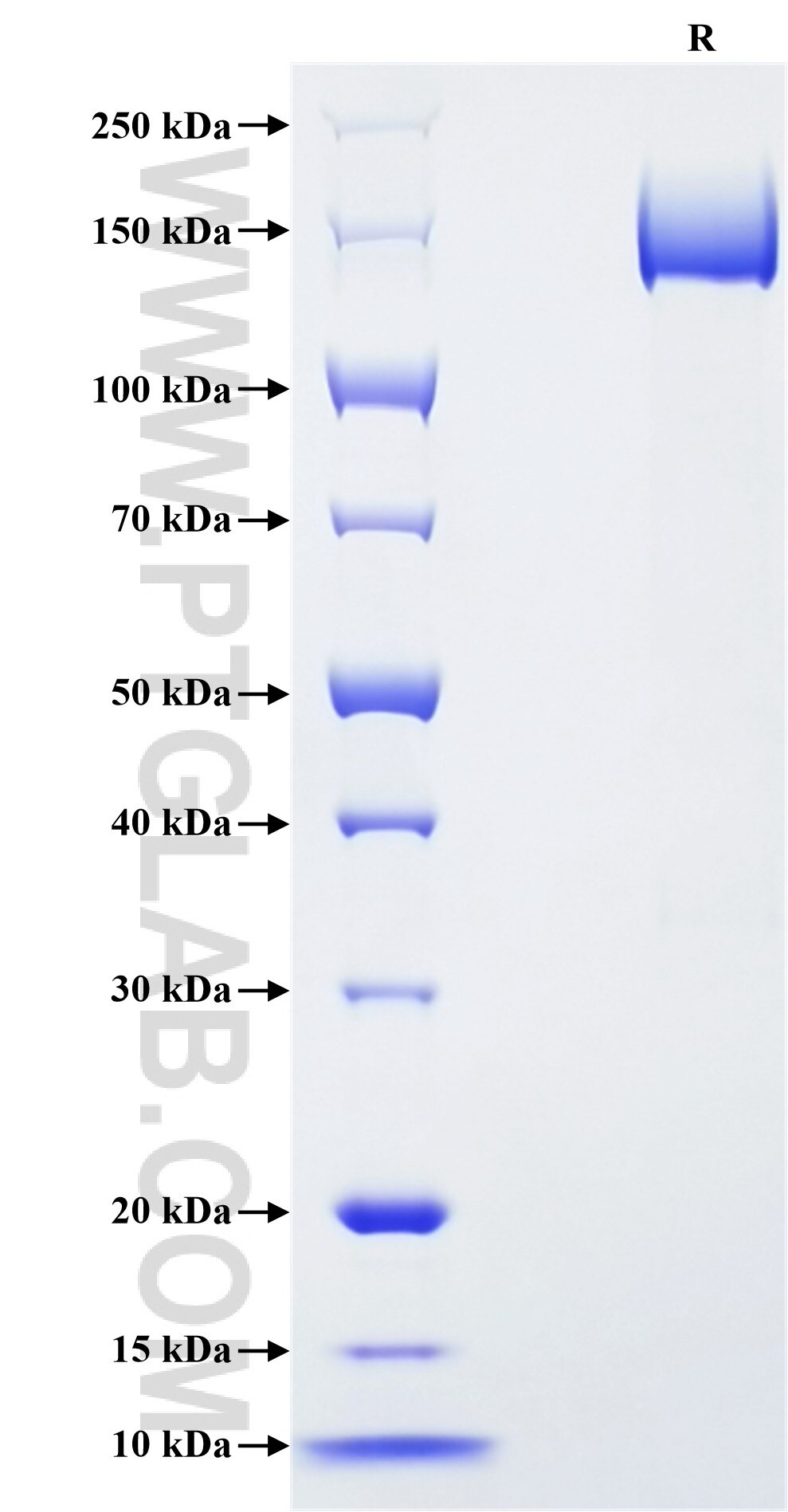 Purity of Recombinant Human Neogenin was determined by SDS-PAGE. The protein was resolved in an SDS-PAGE in reducing (R) conditions and stained using Coomassie blue.