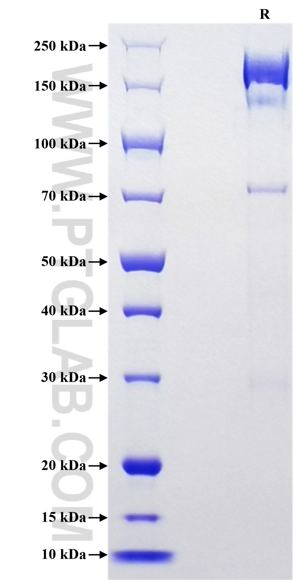 Purity of Recombinant Human NFASC was determined by SDS-PAGE. The protein was resolved in an SDS-PAGE in reducing (R) conditions and stained using Coomassie blue. Purity of Recombinant Human NFASC was determined by SDS-PAGE. The protein was resolved in an SDS-PAGE in reducing (R) conditions and stained using Coomassie blue.