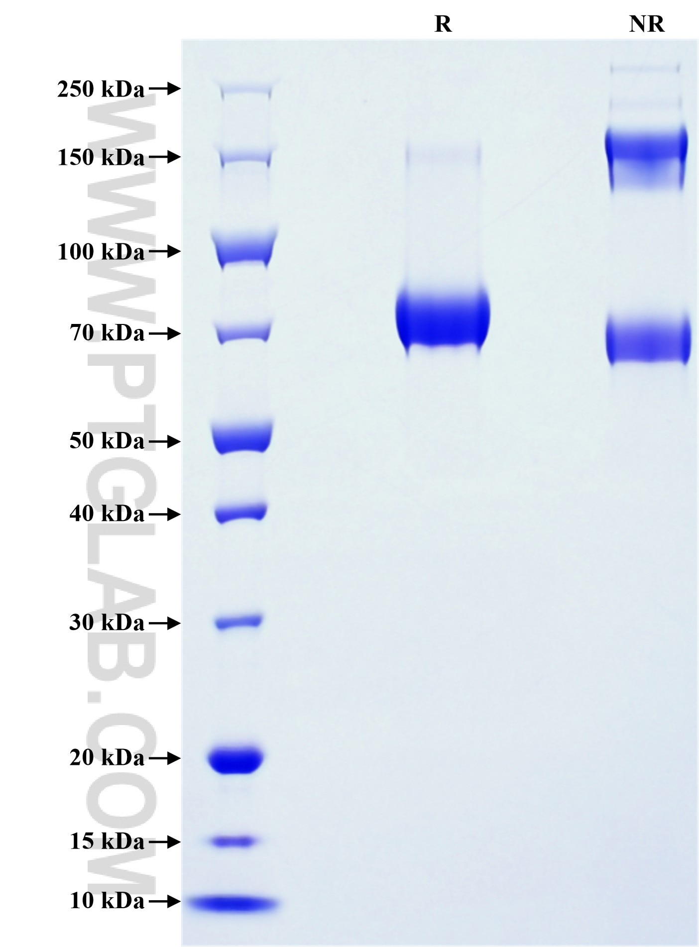 Purity of Recombinant Human NPTN was determined by SDS-PAGE. The protein was resolved in an SDS-PAGE in reducing (R) and non-reducing (NR) conditions and stained using Coomassie blue. Purity of Recombinant Human NPTN was determined by SDS-PAGE. The protein was resolved in an SDS-PAGE in reducing (R) and non-reducing (NR) conditions and stained using Coomassie blue.
