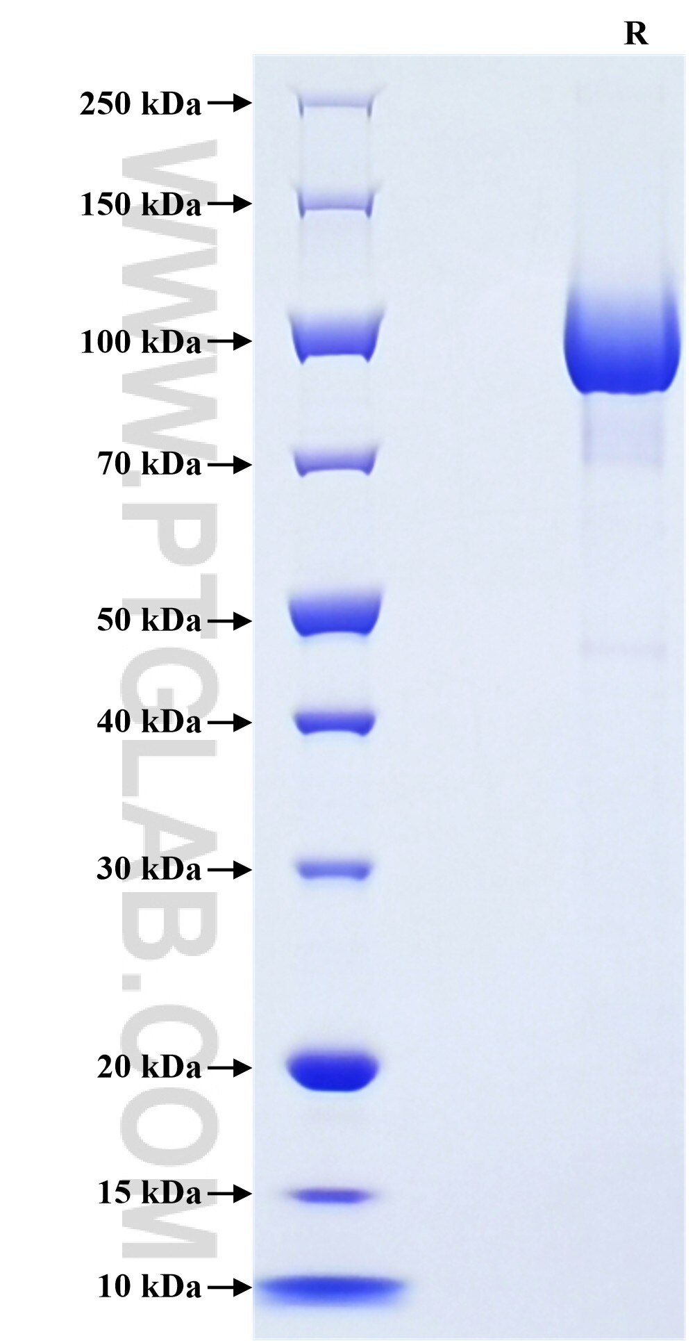 Purity of Recombinant Human CDHR5 was determined by SDS-PAGE. The protein was resolved in an SDS-PAGE in reducing (R) conditions and stained using Coomassie blue. Purity of Recombinant Human CDHR5 was determined by SDS-PAGE. The protein was resolved in an SDS-PAGE in reducing (R) conditions and stained using Coomassie blue.