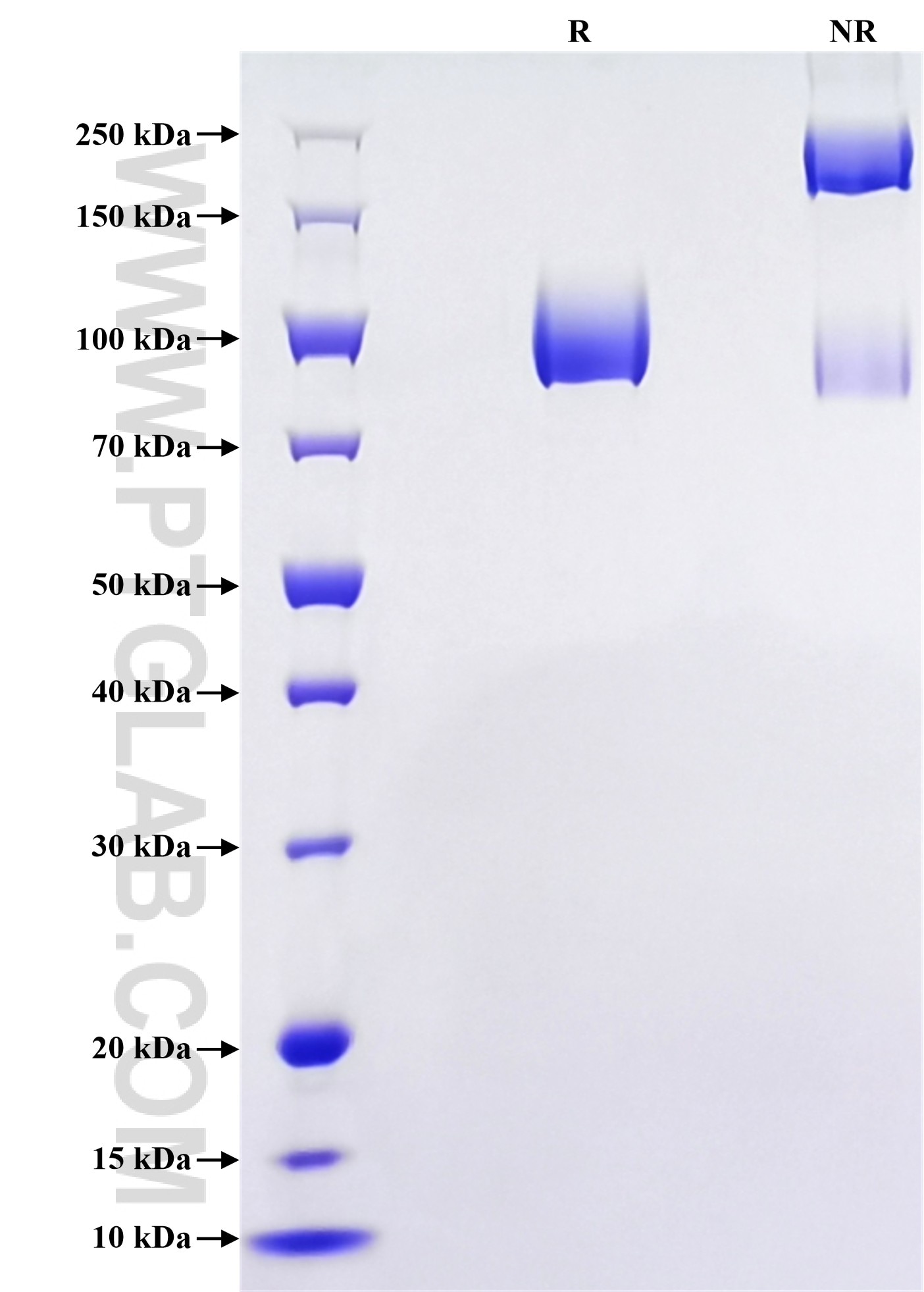 Purity of Recombinant Human TrkC was determined by SDS-PAGE. The protein was resolved in an SDS-PAGE in reducing (R) and non-reducing (NR) conditions and stained using Coomassie blue. Purity of Recombinant Human TrkC was determined by SDS-PAGE. The protein was resolved in an SDS-PAGE in reducing (R) and non-reducing (NR) conditions and stained using Coomassie blue.
