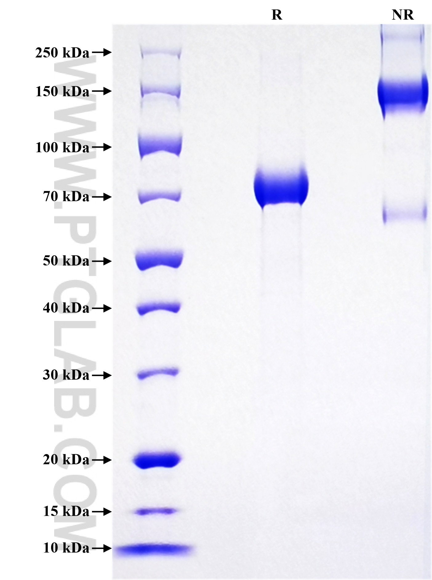Purity of Recombinant Human GFRA3 was determined by SDS-PAGE. The protein was resolved in an SDS-PAGE in reducing (R) and non-reducing (NR) conditions and stained using Coomassie blue. Purity of Recombinant Human GFRA3 was determined by SDS-PAGE. The protein was resolved in an SDS-PAGE in reducing (R) and non-reducing (NR) conditions and stained using Coomassie blue.